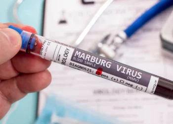 Deadly Marburg Virus Sparks Panic in Germany After Rwanda Outbreak Claims 9 Lives