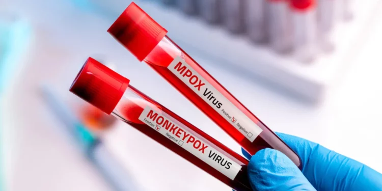 Delay In Funding And Vaccine Delivery, Congo Yet To Launch A Full-Fledged Mpox Vaccine Drive